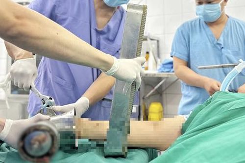 Một phút bất cẩn bên máy xay thịt, người phụ nữ trẻ phải trả giá đắt