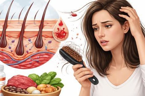 Vì sao thiếu sắt gây rụng tóc?