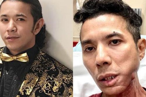 Kasim Hoàng Vũ qua đời sau thời gian bạo bệnh