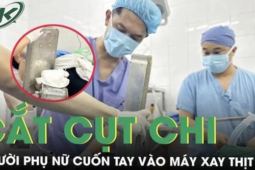 Tay cuốn vào máy xay thịt, người phụ nữ buộc phải cắt cụt chi để giữ mạng sống