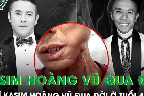 Ca sĩ Kasim Hoàng Vũ qua đời ở tuổi 46 sau thời gian chống chọi bạo bệnh, hình ảnh cuối đầy xúc động