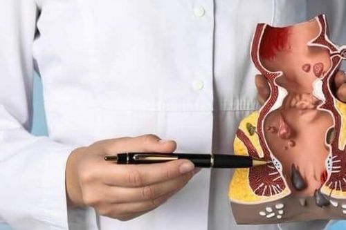 Trĩ xuất huyết: Đừng chủ quan với nguy cơ mất máu nghiêm trọng