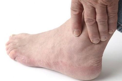 Sai lầm thường gặp chấn thương phần mềm cổ chân