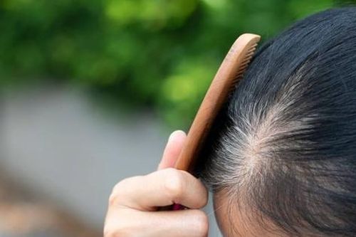 5 thói quen xấu khiến tóc bạc sớm ở người trẻ
