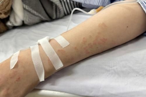 Người phụ nữ nhiễm 5 loại ký sinh trùng khiến bác sĩ ngỡ ngàng