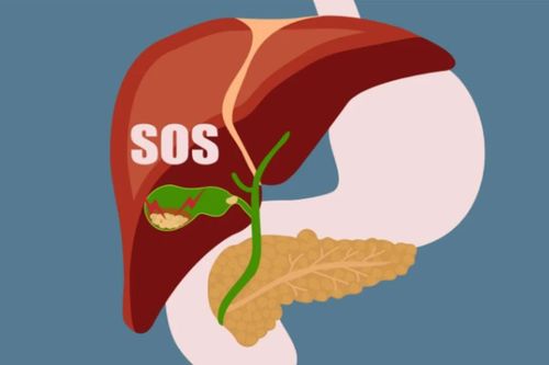 Infograhic: Những dấu hiệu cảnh báo gan đang quá tải