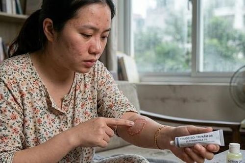 Bệnh nấm da: Nhận biết sớm và dùng thuốc đúng cách để tránh lây lan
