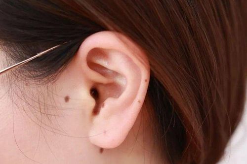 Đừng lướt qua nếu bạn có 5 dấu hiệu này! Xem ngay số 3 để cứu lấy chính mình