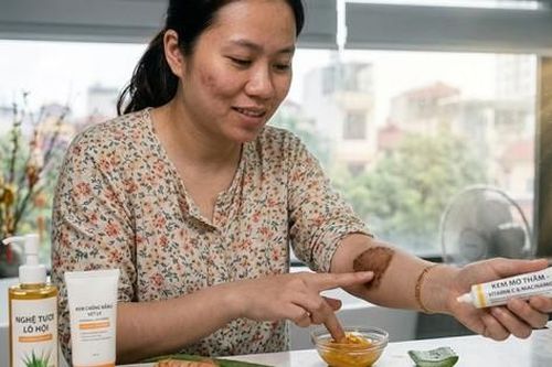 Phục hồi làn da và xóa vết thâm nhanh sau điều trị nấm da