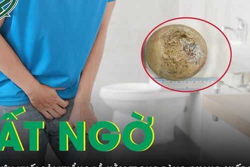 Phát hiện sỏi bàng quang khổng lồ khi bệnh nhân đi khám bệnh khác