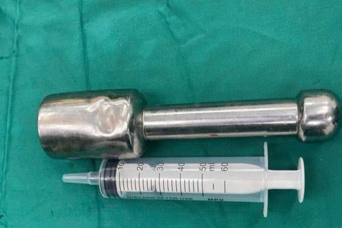 Hy hữu: Thiếu niên 15 tuổi mắc kẹt chiếc chày dài 18cm trong trực tràng