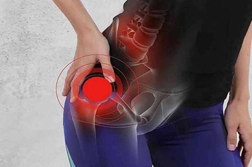 Viêm khớp háng, nhận biết sớm giúp ngăn ngừa hệ lụy