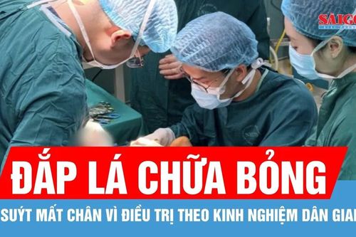 Suýt mất chân vì tự đắp lá chữa bỏng