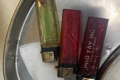 3 chiếc bật lửa trong dạ dày nam thanh niên