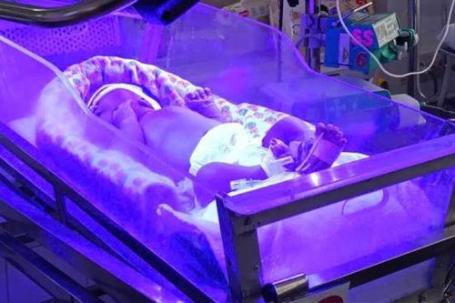 Bé trai chào đời 30 giờ đã phải 'báo động đỏ' thay máu khẩn