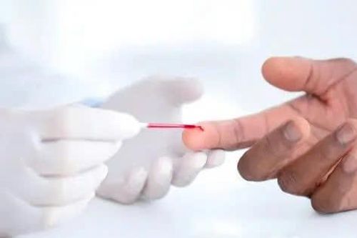 Mỹ khuyến cáo nên tầm soát và điều trị cholesterol từ độ tuổi 30