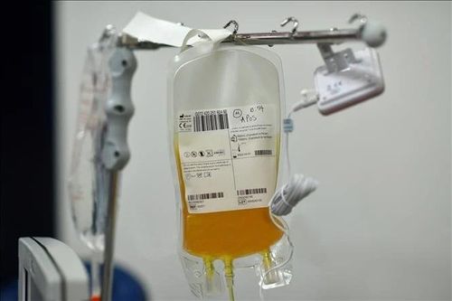 Thời điểm vàng điều trị bệnh tự miễn, tổn thương thận bằng lọc huyết tương