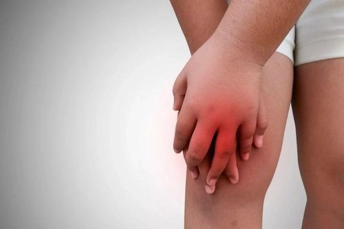 Nhận biết sớm viêm khớp tự phát thiếu niên để bảo vệ trẻ