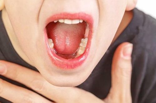 Ngoài dấu hiệu sốt, khi viêm amidan ở trẻ có thêm biểu hiện gì?