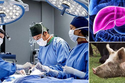 Dùng gan lợn biến đổi gen điều trị bệnh suy gan