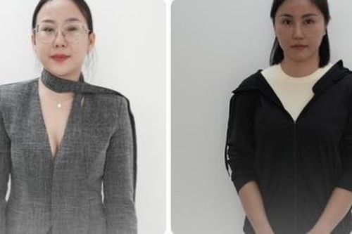 Công an TPHCM: Khởi tố chủ cơ sở làm đẹp BN Center quảng cáo thổi phồng, lừa đảo khách hàng