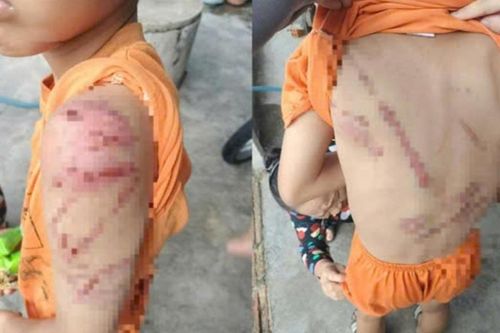 Đánh con trai 10 tuổi bầm tím cơ thể, người đàn ông ở Đắk Lắk bị phạt