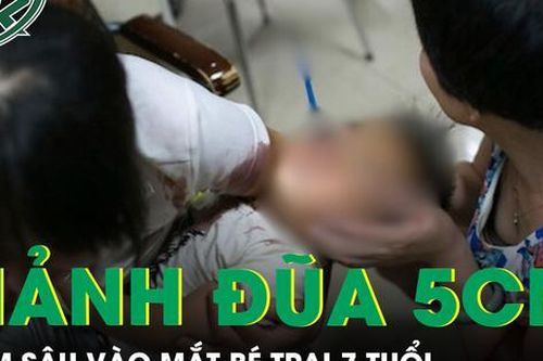 Gắp mảnh đũa gãy dài 5cm trong mắt bé trai 7 tuổi