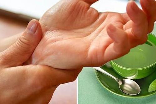 3 dấu hiệu nhận biết giãn dây chằng cổ tay và những biến chứng không nên chủ quan