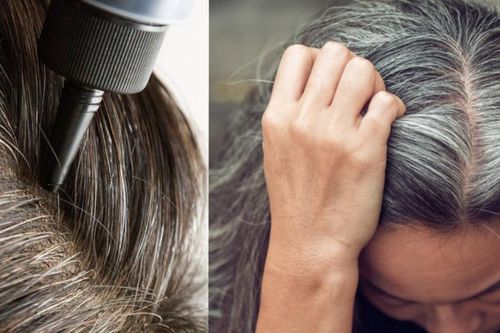 5 cách hạn chế tóc bạc sớm, giúp đen khỏe lâu dài