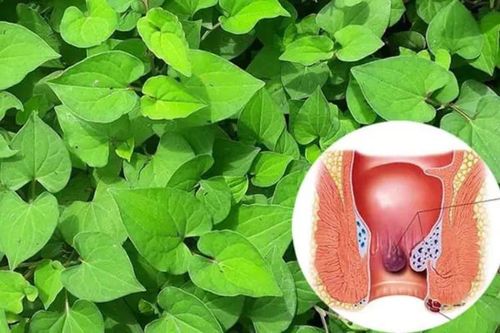 4 loại thảo mộc hỗ trợ cải thiện triệu chứng trĩ hiệu quả