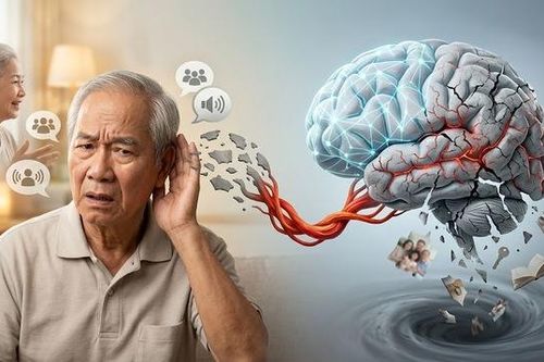 Suy giảm thính lực có thể làm tăng nguy cơ sa sút trí tuệ