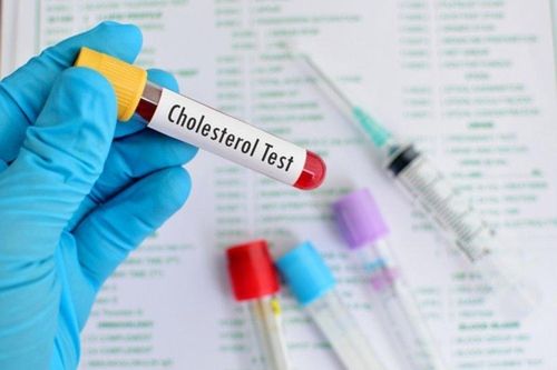 5 cập nhật mới về quản lý cholesterol không cần dùng thuốc