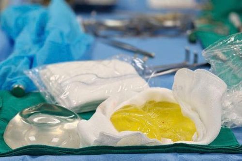 Cô gái trẻ tá hỏa vì túi ngực bỗng nhiên vỡ nát