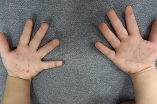 Con đang chơi bỗng khóc ngặt nghẽo, mẹ sững sờ khi phát hiện 'bí mật'