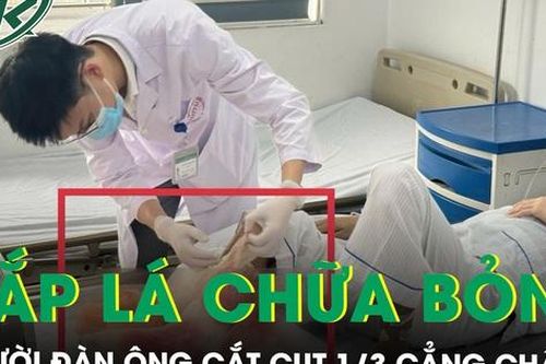 Người đàn ông phải cắt cụt 1/3 cẳng chân vì đắp lá chữa bỏng