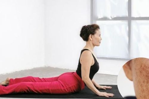 5 tư thế yoga đơn giản hỗ trợ làm mờ nám da tại nhà