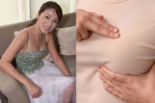 Á hậu Hong Kong mắc ung thư vú giai đoạn cuối dù phát hiện sớm: Dấu hiệu cảnh báo và cách tự kiểm tra