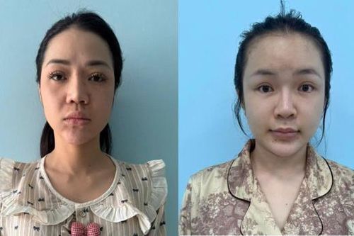 Lần theo dấu vết 'ảo', bóc gỡ đường dây ma túy trên mạng xã hội