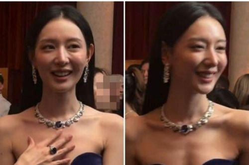 Kim Ji Won khiến fans lo lắng vì diện mạo mới