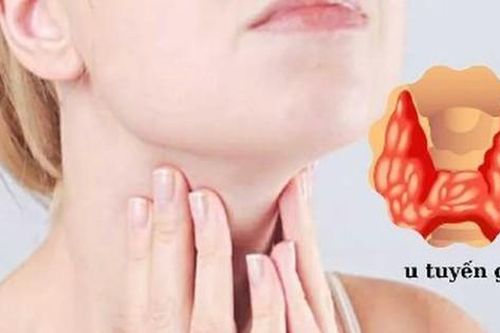 Dược thiện cho tuyến giáp: 5 nhóm thực phẩm bổ trợ và những loại cần kiêng kỵ