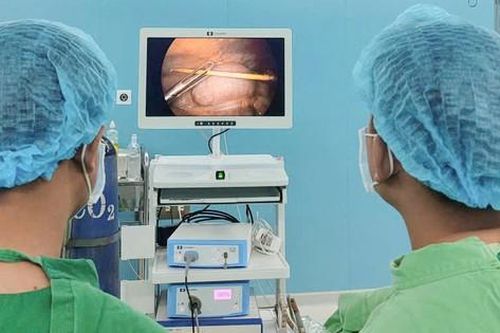 Nuốt tăm không hay biết, người đàn ông 58 tuổi bị thủng đại tràng