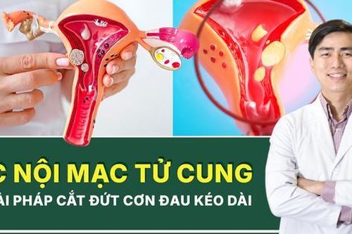 Tăng cường chăm sóc sức khỏe cho phụ nữ mắc bệnh lạc nội mạc tử cung trong bối cảnh mới