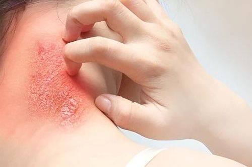 Nguy cơ nhiễm trùng máu có thể xảy ra từ các vết thương nhỏ