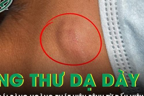 Cô gái 20 tuổi bàng hoàng phát hiện mắc ung thư dạ dày di căn toàn thân từ dấu hiệu ở cổ
