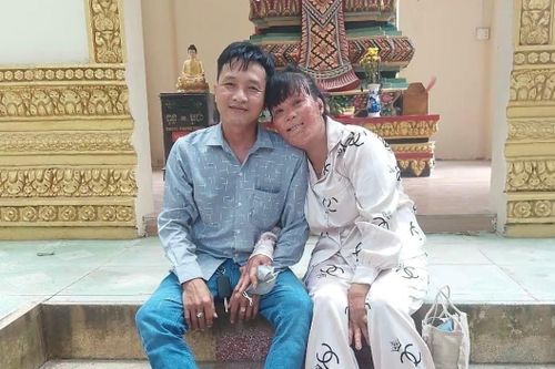 Người phụ nữ bỏng 78% cơ thể vì cứu con riêng của bạn trai sau 19 năm
