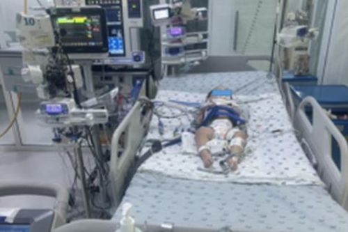 Bé gái hơn 1 tuổi nguy kịch vì phút lơ là của người lớn, bác sĩ cảnh báo thói quen 'chết người'