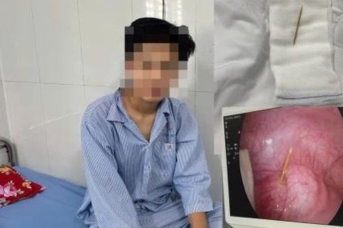 Nuốt tăm tre - nguy cơ tiềm ẩn khó lường