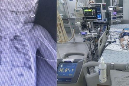 Bé gái hơn 1 tuổi bị ngưng tim, ngưng thở chỉ vì phút lơ là của người lớn: Bác sĩ cảnh báo nguy cơ tiềm ẩn từ những vật dụng quen thuộc này trong nhà