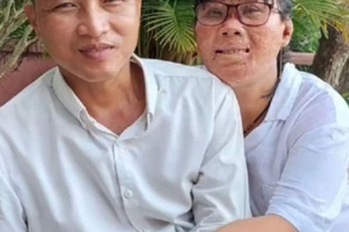 Người phụ nữ cứu con của bạn trai khỏi biển lửa, bị bỏng 78% cơ thể 19 năm trước, giờ ra sao?