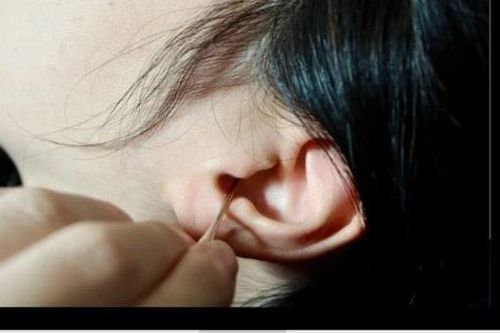 Cảnh báo các dấu hiệu ráy tai bất thường, cách xử lý